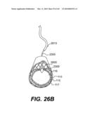 ENDOVASCULAR DEVICES AND METHODS FOR EXPLOITING INTRAMURAL SPACE diagram and image