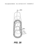 ENDOVASCULAR DEVICES AND METHODS FOR EXPLOITING INTRAMURAL SPACE diagram and image