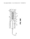 ENDOVASCULAR DEVICES AND METHODS FOR EXPLOITING INTRAMURAL SPACE diagram and image