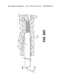 ENDOVASCULAR DEVICES AND METHODS FOR EXPLOITING INTRAMURAL SPACE diagram and image