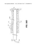 ENDOVASCULAR DEVICES AND METHODS FOR EXPLOITING INTRAMURAL SPACE diagram and image