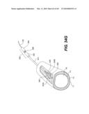 ENDOVASCULAR DEVICES AND METHODS FOR EXPLOITING INTRAMURAL SPACE diagram and image