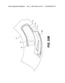 ENDOVASCULAR DEVICES AND METHODS FOR EXPLOITING INTRAMURAL SPACE diagram and image