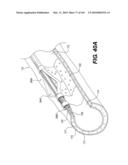 ENDOVASCULAR DEVICES AND METHODS FOR EXPLOITING INTRAMURAL SPACE diagram and image