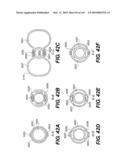 ENDOVASCULAR DEVICES AND METHODS FOR EXPLOITING INTRAMURAL SPACE diagram and image