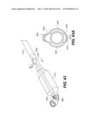 ENDOVASCULAR DEVICES AND METHODS FOR EXPLOITING INTRAMURAL SPACE diagram and image