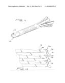 METHOD OF REMOVING A VEIN FILTER diagram and image