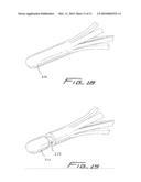 METHOD OF REMOVING A VEIN FILTER diagram and image