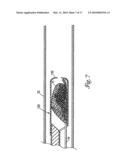 DOUBLE ENDED INTRAVASCULAR MEDICAL DEVICE diagram and image