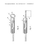 DOUBLE ENDED INTRAVASCULAR MEDICAL DEVICE diagram and image