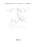 SURGICAL GRASPING DEVICE diagram and image