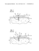 KNOTLESS SUTURE ANCHOR FOR SOFT TISSUE REPAIR AND METHOD OF USE diagram and image