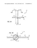 KNOTLESS SUTURE ANCHOR FOR SOFT TISSUE REPAIR AND METHOD OF USE diagram and image