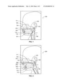 Pacifier diagram and image