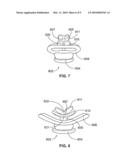 Pacifier diagram and image