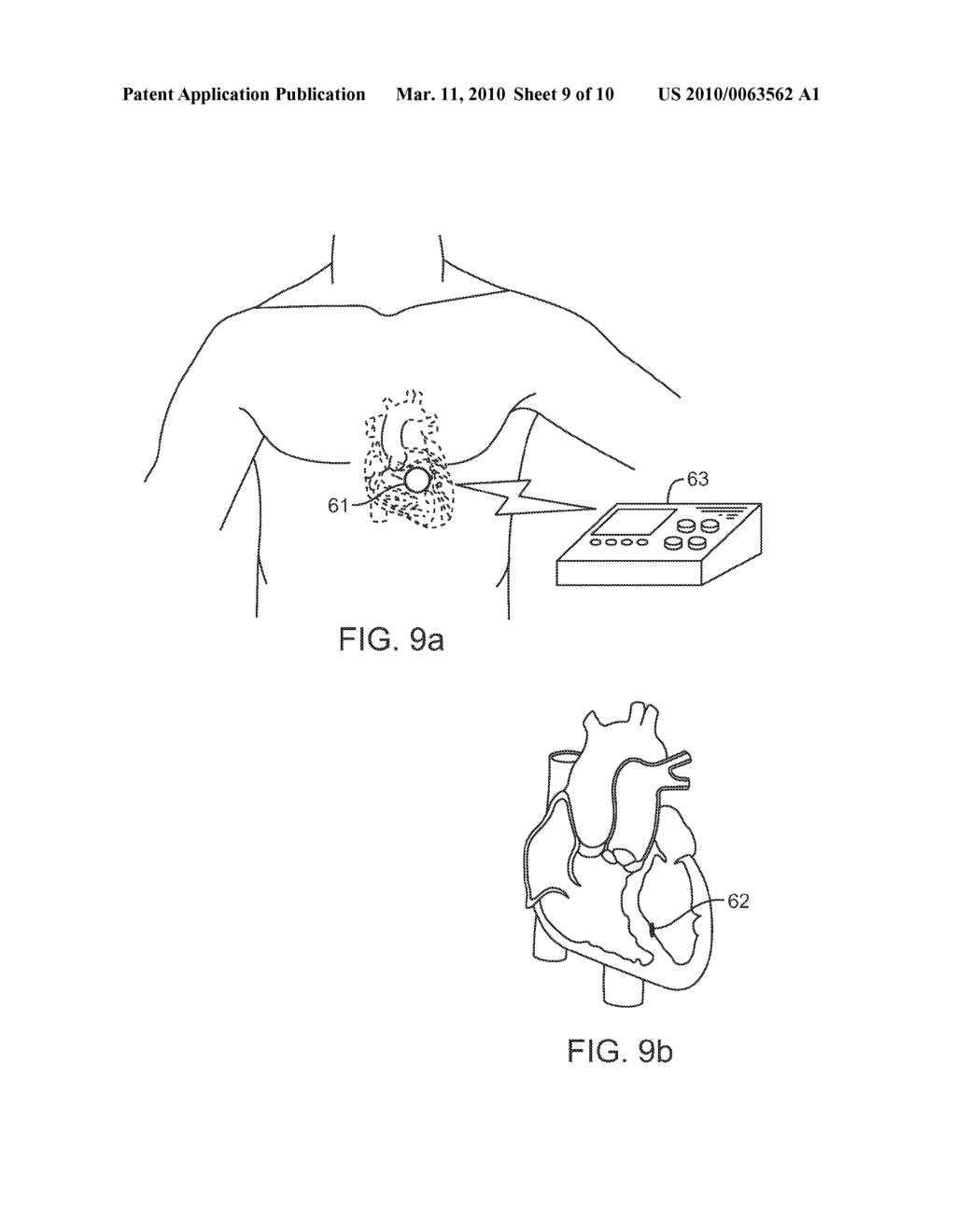 LEADLESS TISSUE STIMULATION SYSTEMS AND METHODS - diagram, schematic, and image 10