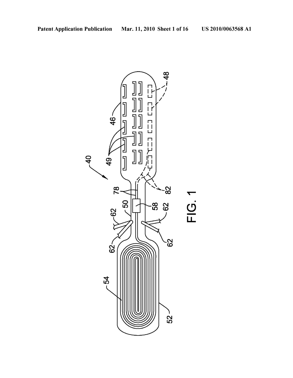 IMPLANTABLE ELECTRODE ARRAY ASSEMBLY WITH EXTRACTION SLEEVE/TETHER - diagram, schematic, and image 02