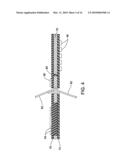 IMPLANTABLE ELECTRODE ARRAY ASSEMBLY WITH EXTRACTION SLEEVE/TETHER diagram and image