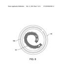 IMPLANTABLE ELECTRODE ARRAY ASSEMBLY WITH EXTRACTION SLEEVE/TETHER diagram and image