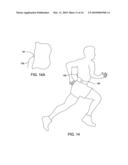 IMPLANTABLE ELECTRODE ARRAY ASSEMBLY WITH EXTRACTION SLEEVE/TETHER diagram and image