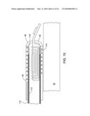 IMPLANTABLE ELECTRODE ARRAY ASSEMBLY WITH EXTRACTION SLEEVE/TETHER diagram and image