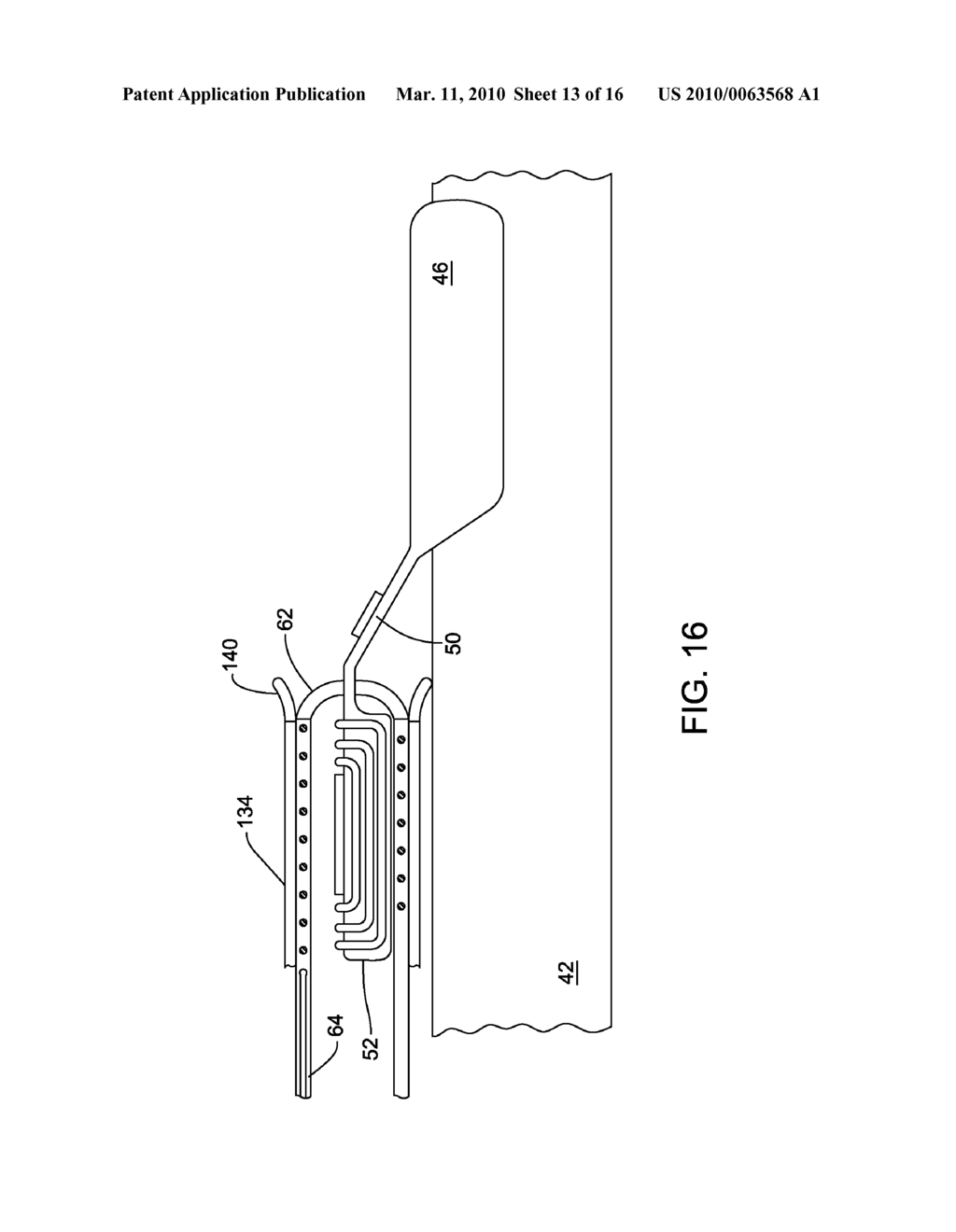 IMPLANTABLE ELECTRODE ARRAY ASSEMBLY WITH EXTRACTION SLEEVE/TETHER - diagram, schematic, and image 14