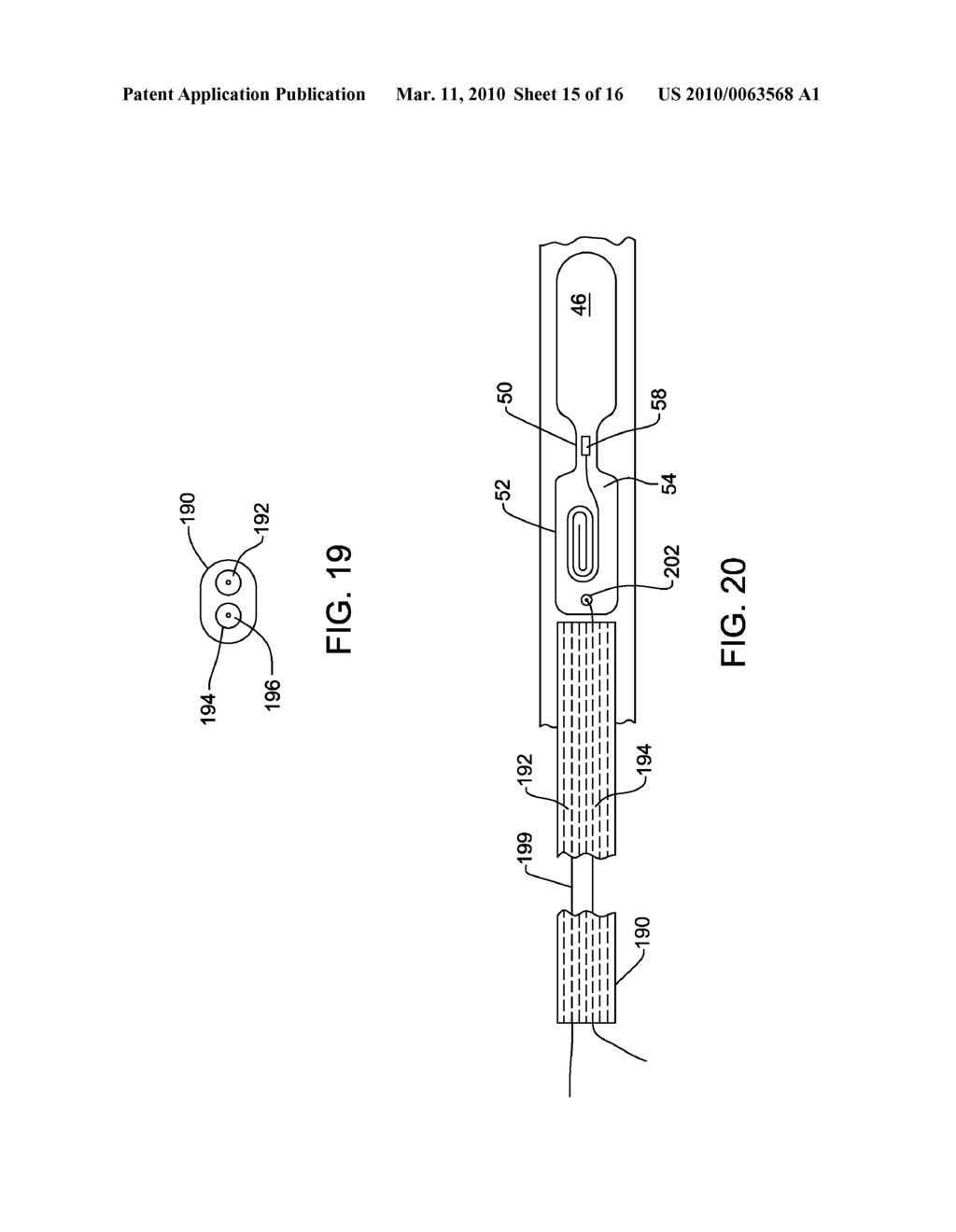 IMPLANTABLE ELECTRODE ARRAY ASSEMBLY WITH EXTRACTION SLEEVE/TETHER - diagram, schematic, and image 16