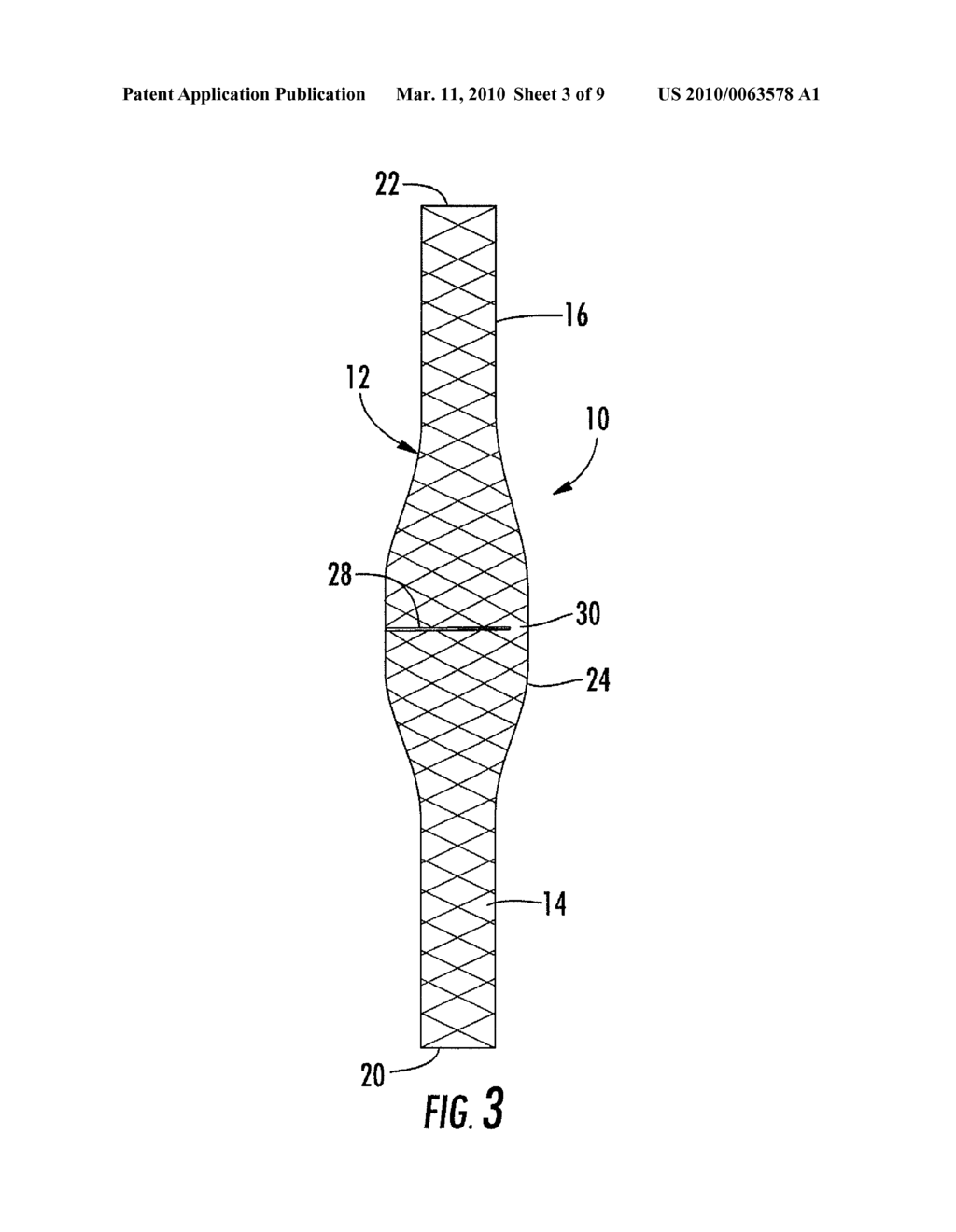 BIFURCATED MEDICAL DEVICE FOR TREATING A TARGET SITE AND ASSOCIATED METHOD - diagram, schematic, and image 04