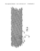 Endoprosthesis For Controlled Contraction And Expansion diagram and image