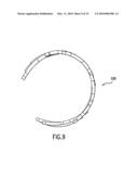 Endoprosthesis For Controlled Contraction And Expansion diagram and image