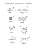 Endoprosthesis For Controlled Contraction And Expansion diagram and image