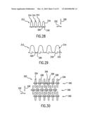 Endoprosthesis For Controlled Contraction And Expansion diagram and image