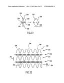 Endoprosthesis For Controlled Contraction And Expansion diagram and image