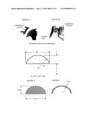 SHOULDER JOINT IMPLANT diagram and image