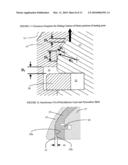 SHOULDER JOINT IMPLANT diagram and image