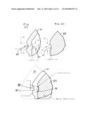 SHOULDER JOINT IMPLANT diagram and image