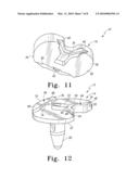 FIXED-BEARING KNEE PROSTHESIS HAVING INTERCHANGEABLE COMPONENTS diagram and image
