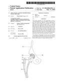 JOINT SOCKET AND HIP ENDOPROSTHESIS HAVING THE SAME diagram and image