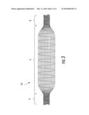 DEVICE FOR SOFT TISSUE REPAIR OR REPLACEMENT diagram and image