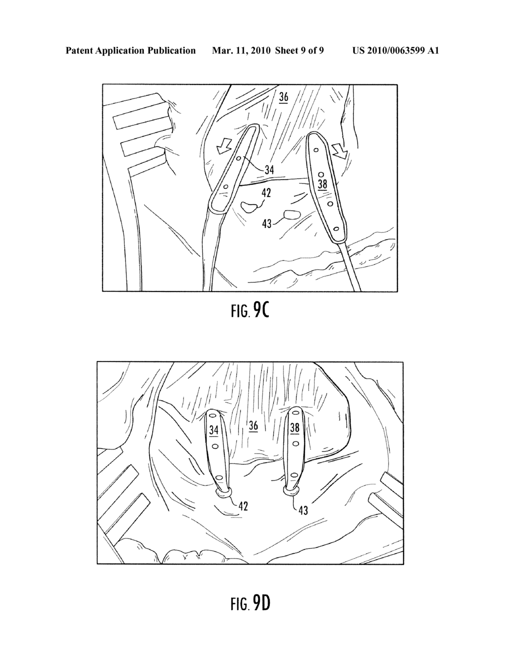 DEVICE FOR SOFT TISSUE REPAIR OR REPLACEMENT - diagram, schematic, and image 10