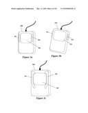 ELECTRONIC DOCUMENT EDITING EMPLOYING MULTIPLE CURSORS diagram and image