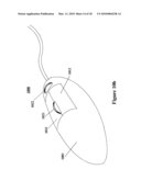 ELECTRONIC DOCUMENT EDITING EMPLOYING MULTIPLE CURSORS diagram and image