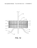 Shrimp basket diagram and image