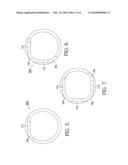 Cam phaser helical bias spring having a square end for retention diagram and image