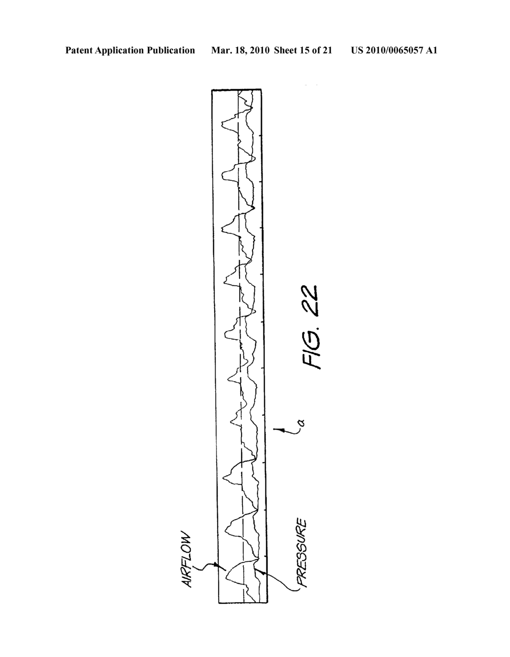 METHOD AND APPARATUS FOR PROVIDING VENTILATORY ASSISTANCE - diagram, schematic, and image 16