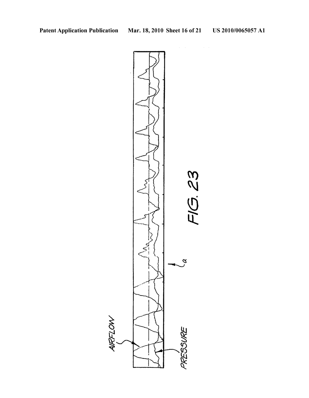 METHOD AND APPARATUS FOR PROVIDING VENTILATORY ASSISTANCE - diagram, schematic, and image 17