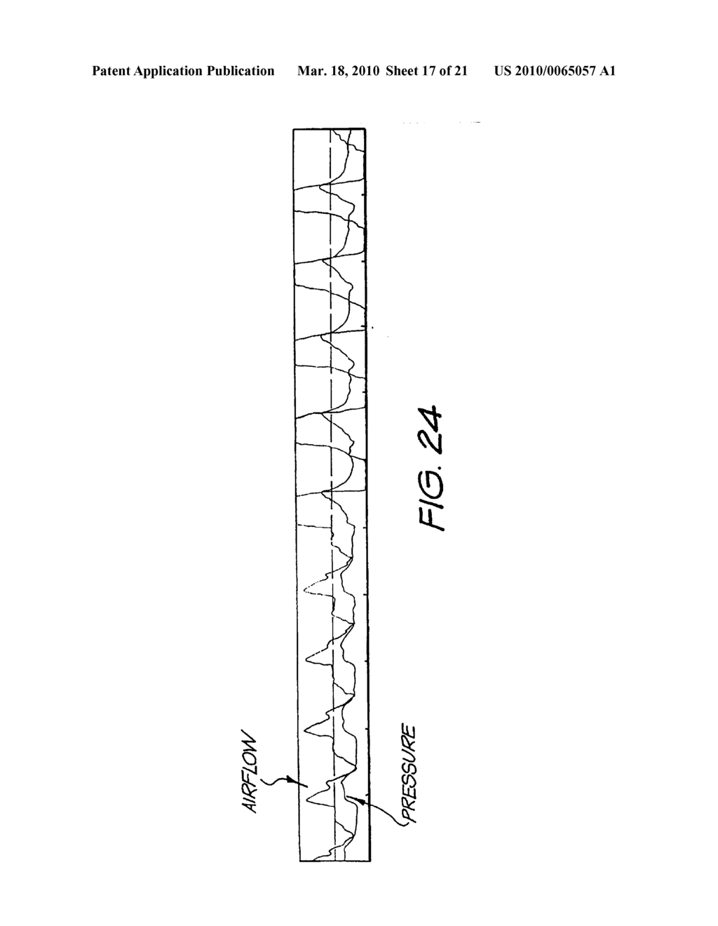 METHOD AND APPARATUS FOR PROVIDING VENTILATORY ASSISTANCE - diagram, schematic, and image 18