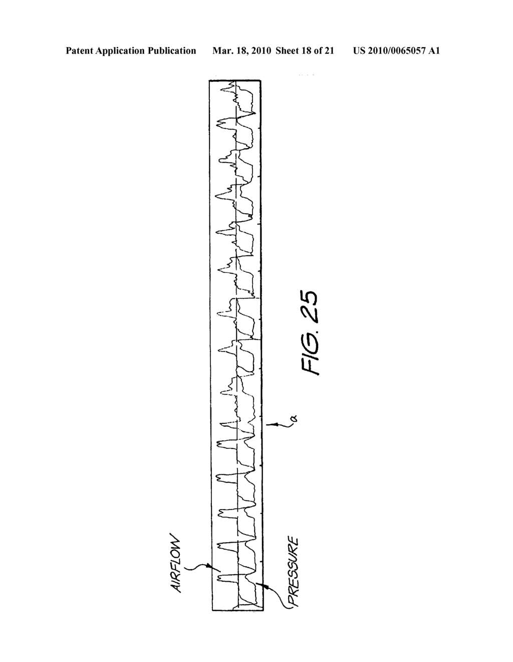 METHOD AND APPARATUS FOR PROVIDING VENTILATORY ASSISTANCE - diagram, schematic, and image 19