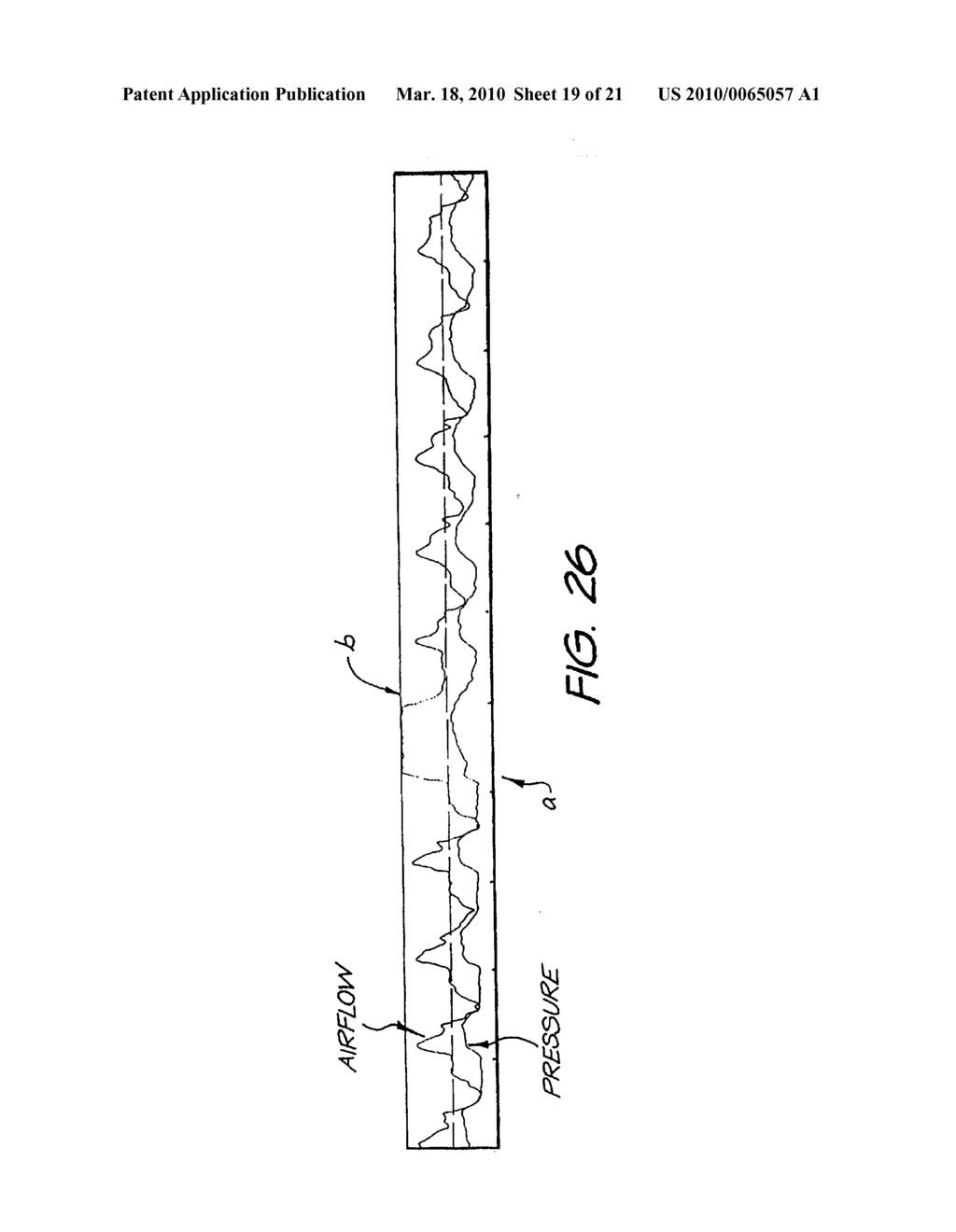 METHOD AND APPARATUS FOR PROVIDING VENTILATORY ASSISTANCE - diagram, schematic, and image 20