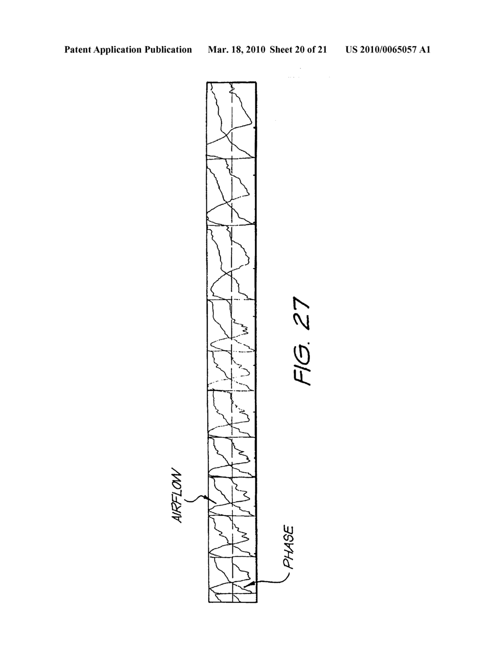 METHOD AND APPARATUS FOR PROVIDING VENTILATORY ASSISTANCE - diagram, schematic, and image 21